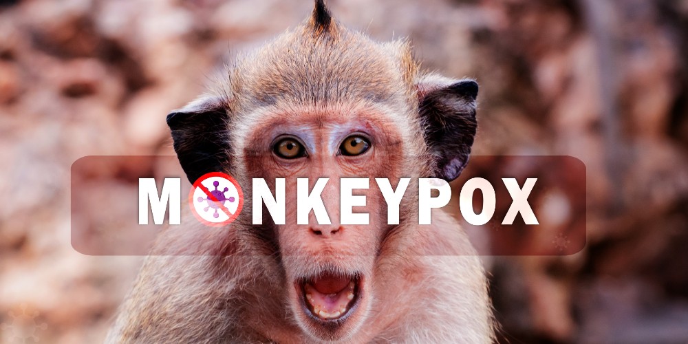 Monkeypox (1)