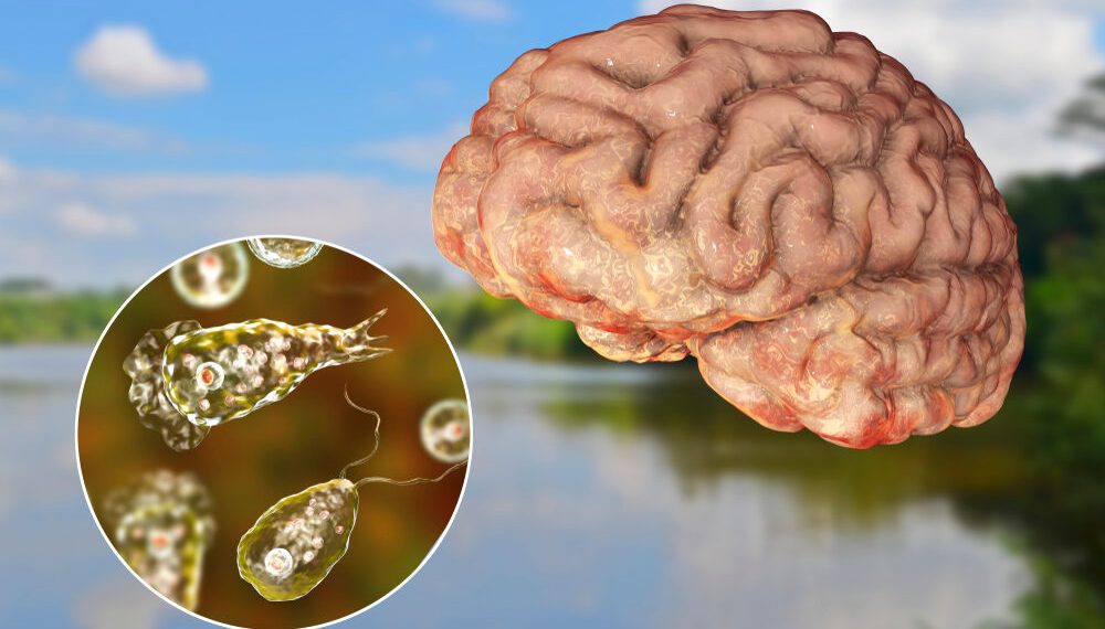 Brain eating amoeba appears to be spreading North across the U.S.