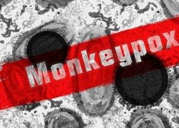 Monkeypox