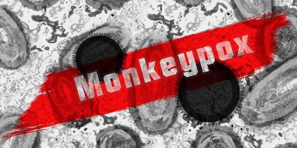 Monkeypox