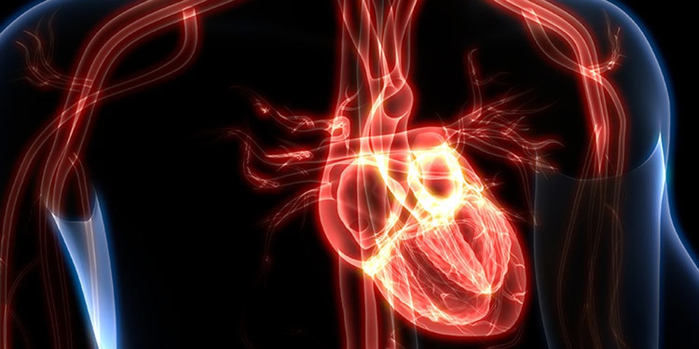 Myocarditis