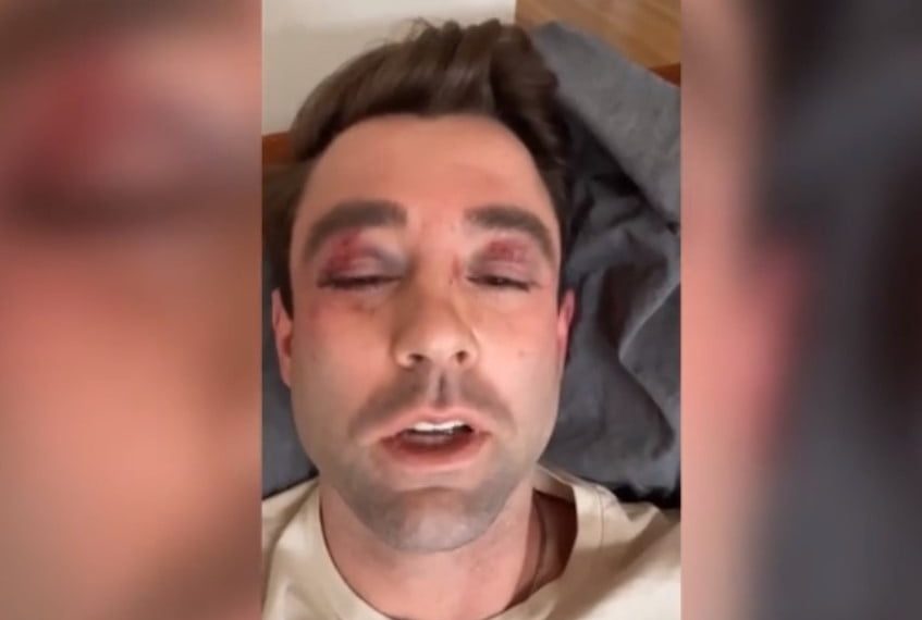 FOX News Meteorologist Violently Beaten on New York Subway