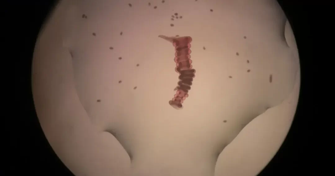 New Compounds May Promote Scar-Free Wound Healing, Animal Study Finds