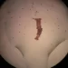New Compounds May Promote Scar-Free Wound Healing, Animal Study Finds