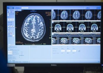 Are Conservative and Liberal Brains Different? Maybe Just a Little