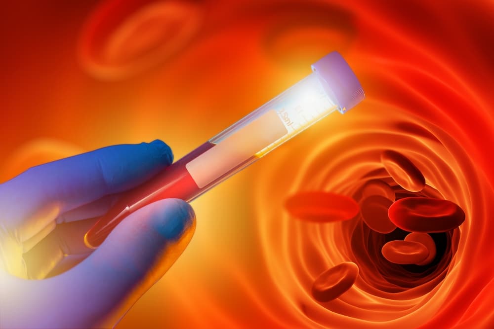 Study finds simple blood test could predict a person’s heart disease risk 30 years out