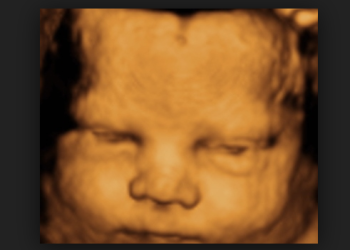 We Must Win Elections Without Sacrificing Unborn Babies