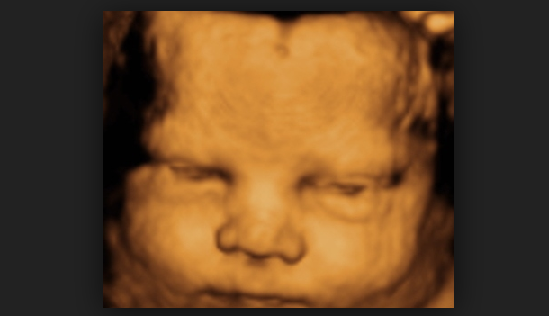 We Must Win Elections Without Sacrificing Unborn Babies