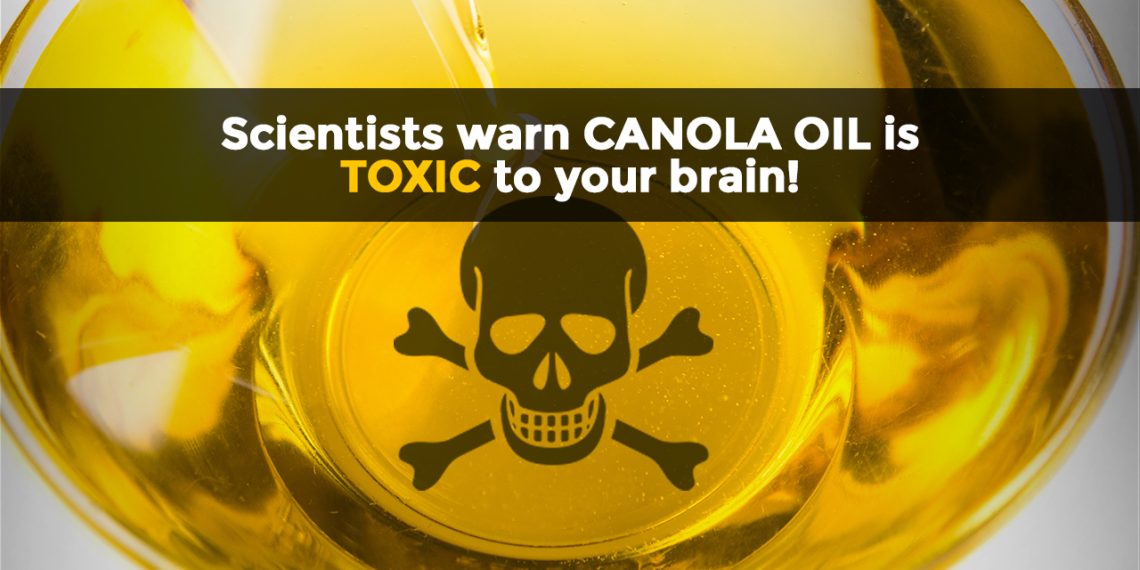 MOST HEALTH-DAMAGING OIL? Canola oil in most processed foods linked to rapid weight gain, early onset dementia, cancer