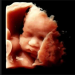 Abortion is Not a “Loving Act” Because You Don’t Kill the People You Love