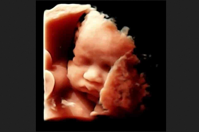 Abortion is Not a “Loving Act” Because You Don’t Kill the People You Love