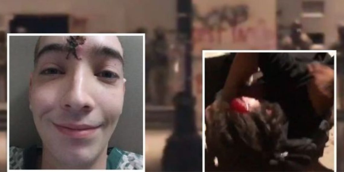 DOJ to pay Portland anti-cop militant $7.65 MILLION over injury during 2020 riot outside federal courthouse after he threw gas grenade at police