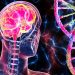 Neurodegenerative Disorders